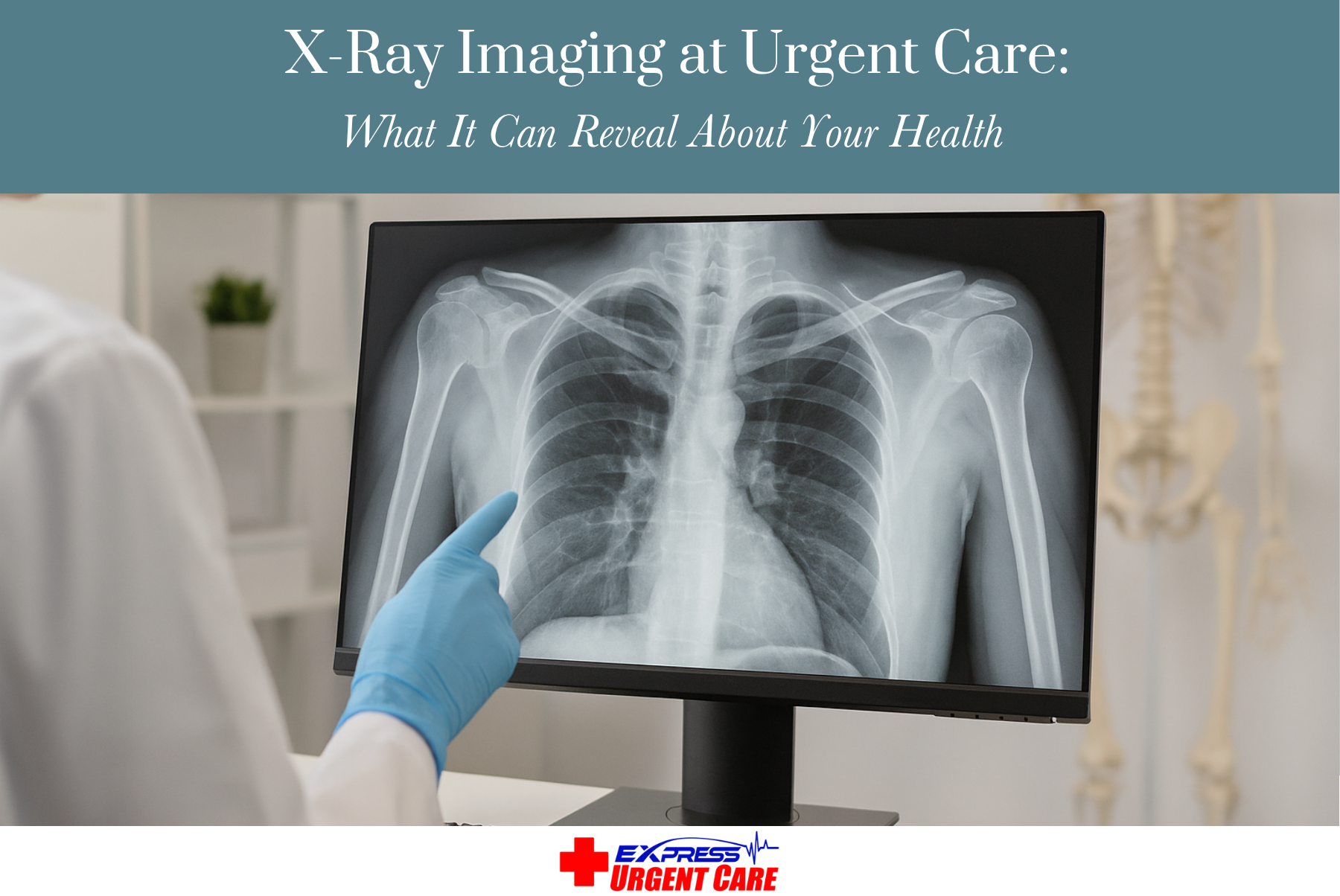 X-Ray Imaging at Urgent Care: What It Can Reveal About Your Health